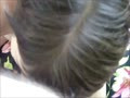 Blasen
